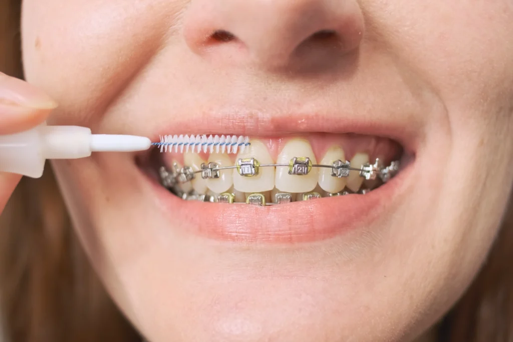 adobestock Hygiène bucco-dentaire Drs Haïm - Orthodontistes à Paris 15