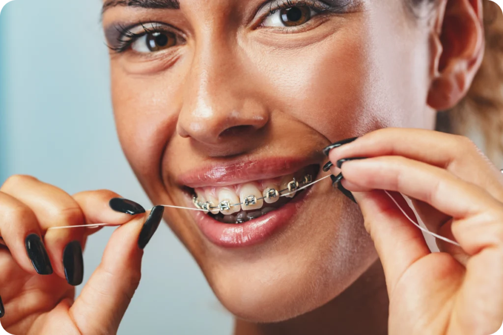 adobestock Alimentation pendant un traitement Drs Haïm - Orthodontistes à Paris 15