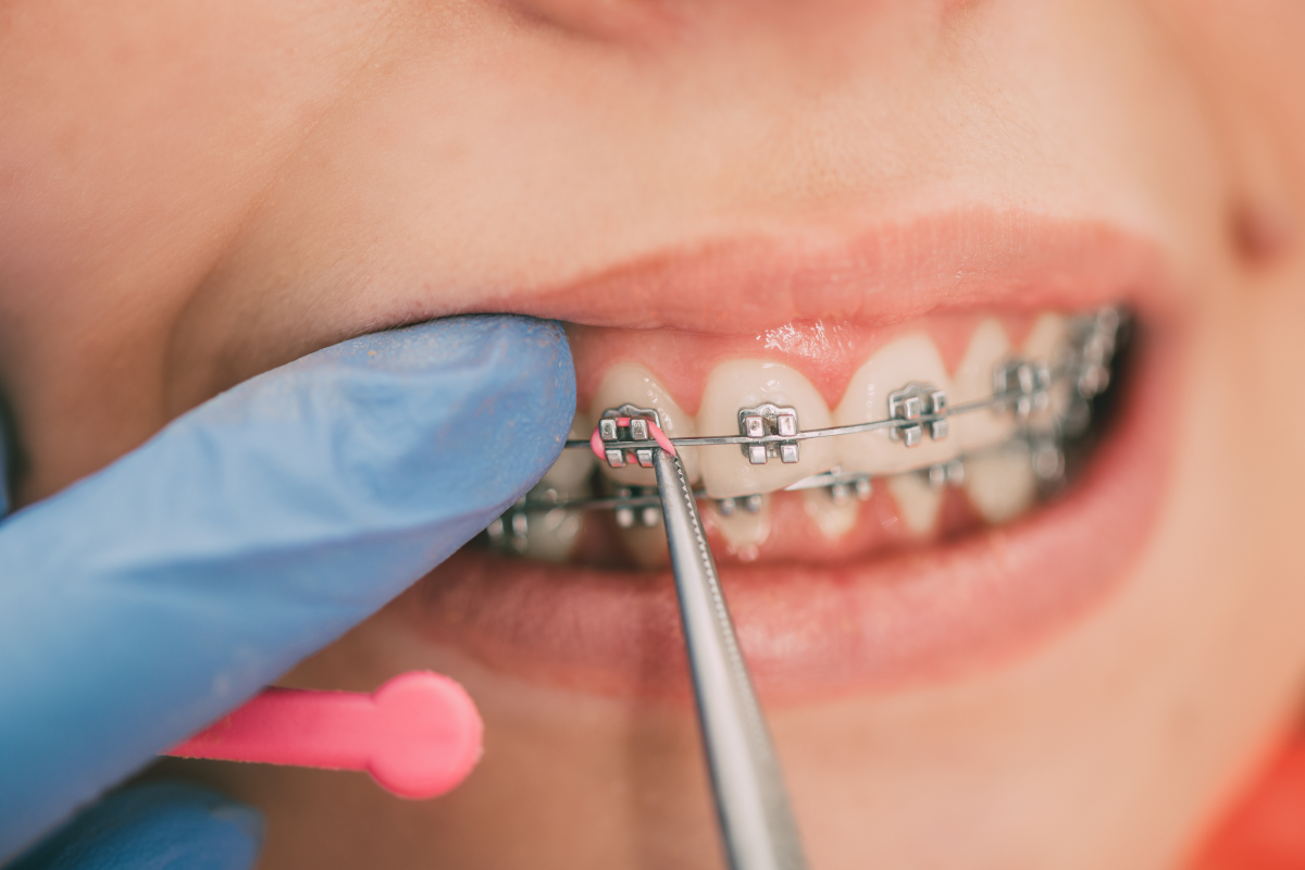 adobestock Nos conseils Drs Haïm - Orthodontistes à Paris 15
