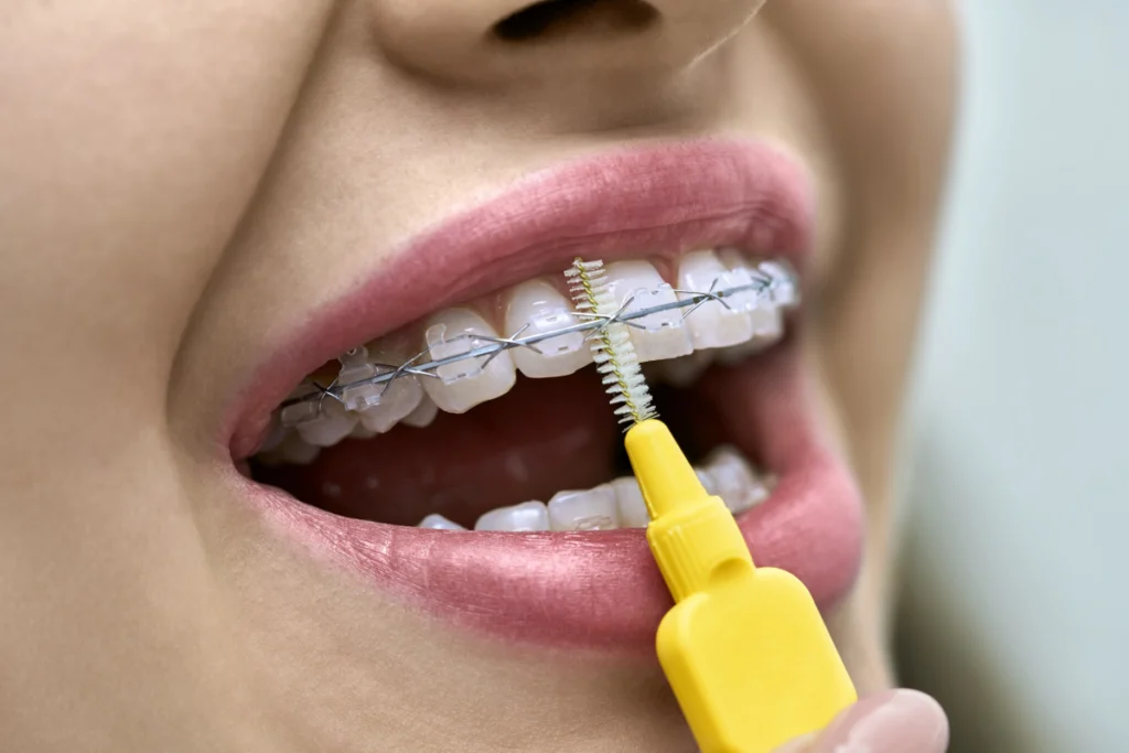 adobestock Nos conseils Drs Haïm - Orthodontistes à Paris 15