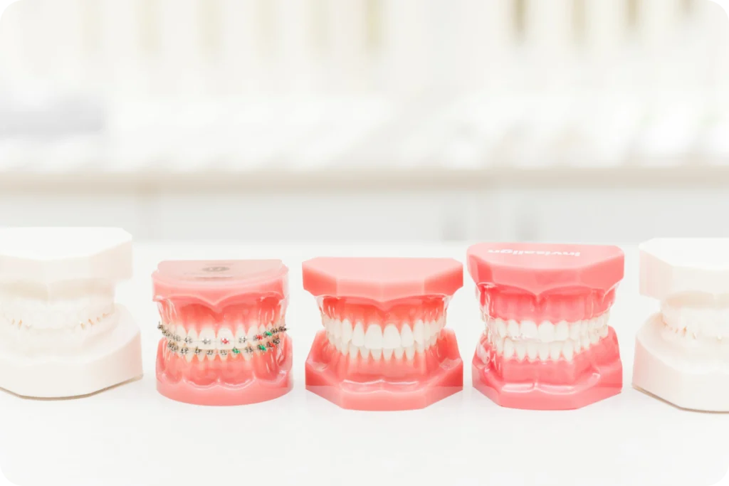 adobestock Appareils dentaires Drs Haïm - Orthodontistes à Paris 15