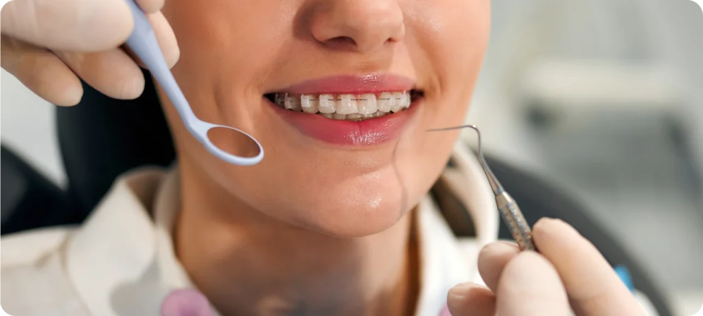 adobestock Appareils dentaires Drs Haïm - Orthodontistes à Paris 15