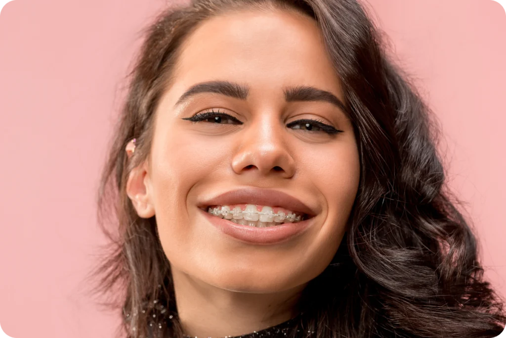 Orthodontie adulte