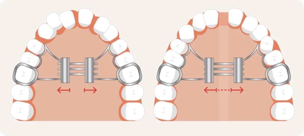 adobestock Activer son disjoncteur Drs Haïm - Orthodontistes à Paris 15